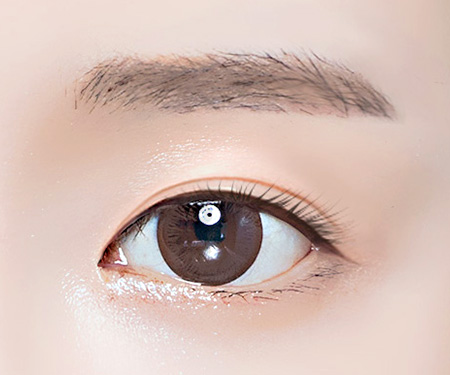 자연유착 쌍꺼풀 수술방법