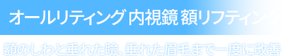 オールリティング 内視鏡 額リフティング